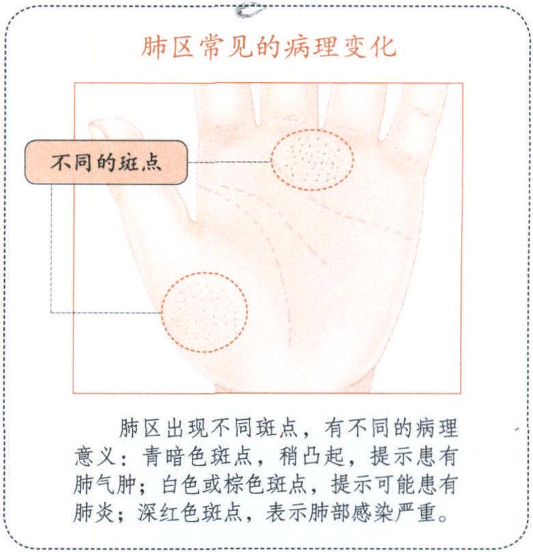手掌上的肺區(qū)